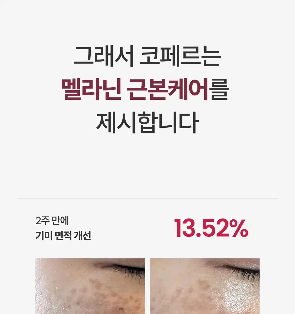 [기미원데이키트] 코페르 큐리페어 멜더 SOS 시스템 5개입 (1.5ml*5ea) 상세페이지 24